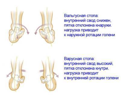 ГИГИЕНА ОСАНКИ: Воспитание и Коррекция