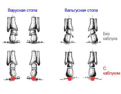 ГИГИЕНА ОСАНКИ: Воспитание и Коррекция