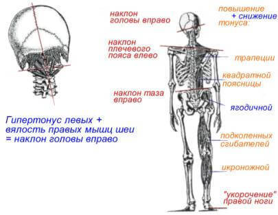 ГИГИЕНА ОСАНКИ: Воспитание и Коррекция