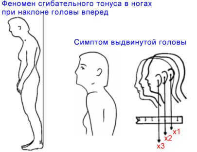 ГИГИЕНА ОСАНКИ: Воспитание и Коррекция