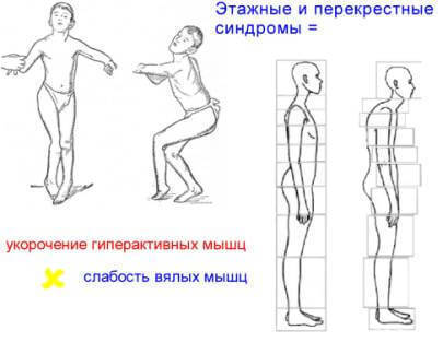 ГИГИЕНА ОСАНКИ: Воспитание и Коррекция