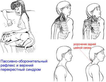 ГИГИЕНА ОСАНКИ: Воспитание и Коррекция