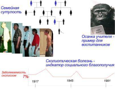 ГИГИЕНА ОСАНКИ: Воспитание и Коррекция