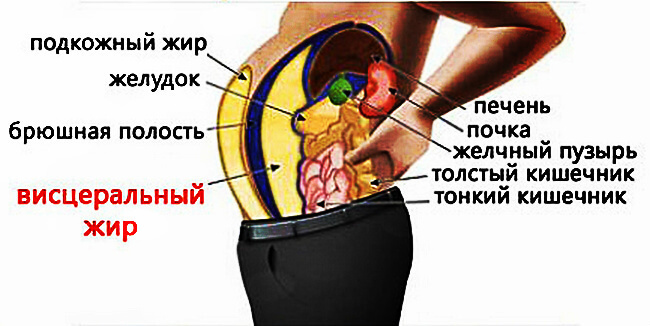 Висцеральный жир: источник проблем у мужчин