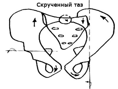 Ассиметрии в строении тела человека