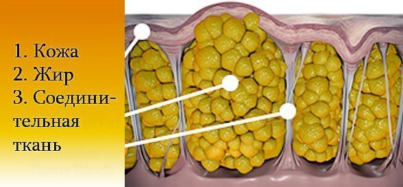 Целлюлит как самый великий всемирный обман