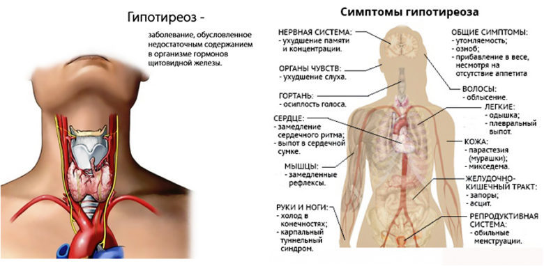 4 ошибки, которые совершают больные гипотериозом, стремясь похудеть