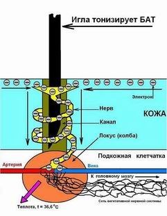 Лечебное действия иглы при акупунктуре