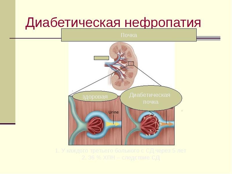 КАК сахар УНИЧТОЖАЕТ вашу печень и мозг