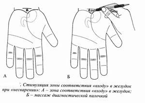 Су-джок-терапия: лечебные точки при несварении желудка