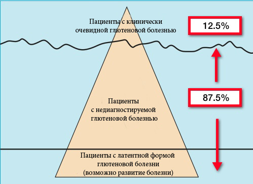 4 пищевых токсина – главные виновники развития болезней