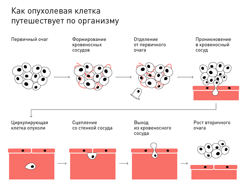 Что за болезнь: рак?