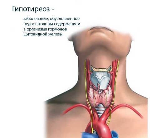 Почему НЕЛЬЗЯ проводить детоксикацию организма при гипотиреозе