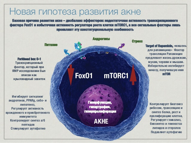 Эпидемия акне (прыщей): вершина айсберга