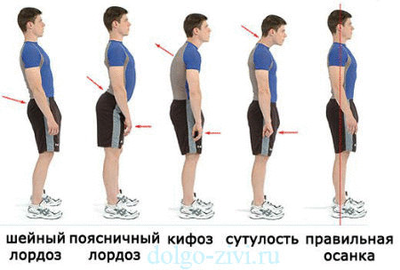 Что делать, чтобы сохранить  позвоночник