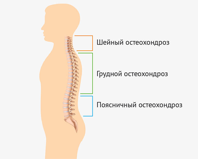 Беспредел бездействия, или Законы остеохондроза