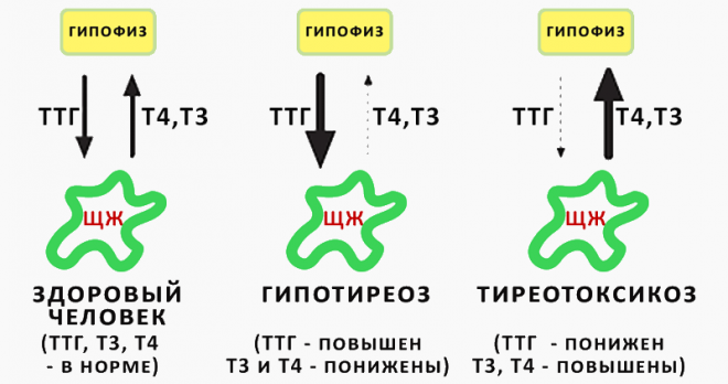 Гипотиреоз, мозг и когнитивные навыки