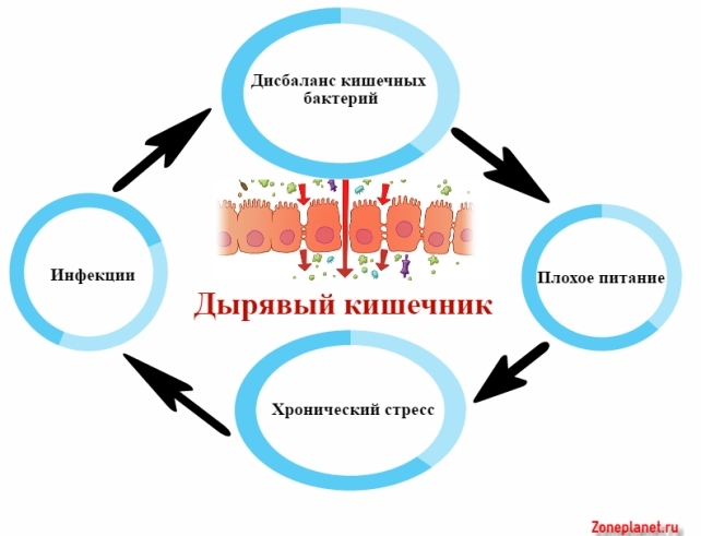 Дырявый кишечник: симптомы, причины и лечение