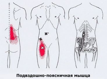 Карта триггеров: точки боли и точки напряжения мышц 