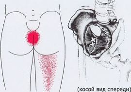 Карта триггеров: точки боли и точки напряжения мышц 