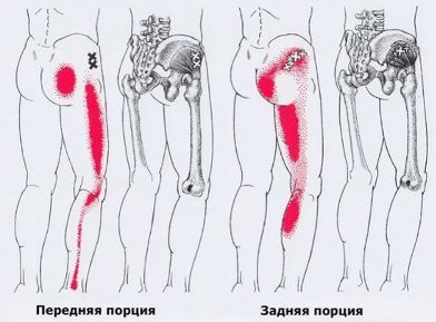 Карта триггеров: точки боли и точки напряжения мышц 