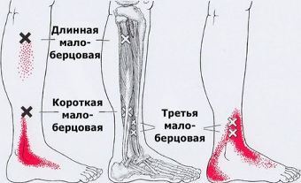 Карта триггеров: точки боли и точки напряжения мышц 