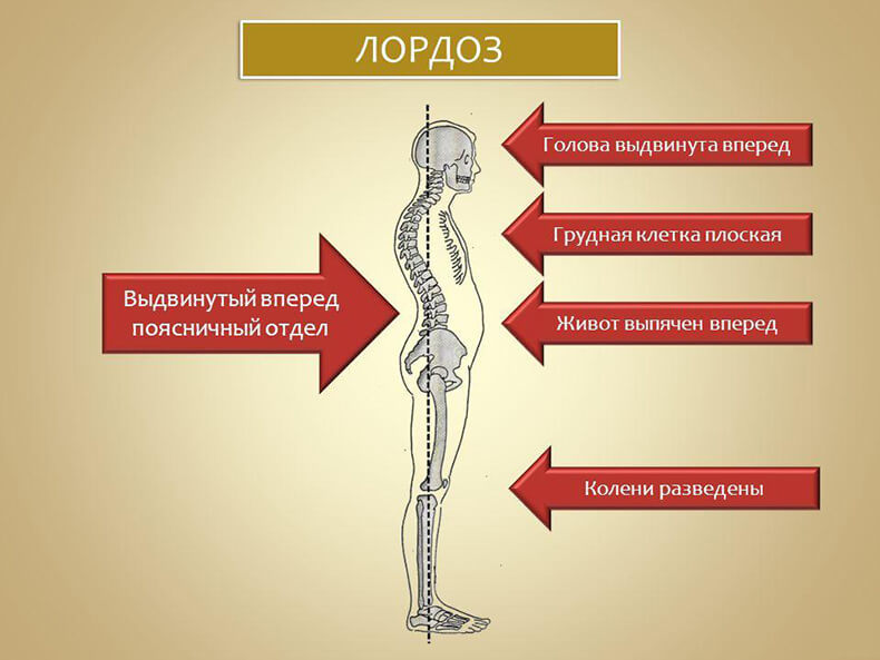 Упражнения для правильной осанки и устранения дефектов костно-мышечной системы