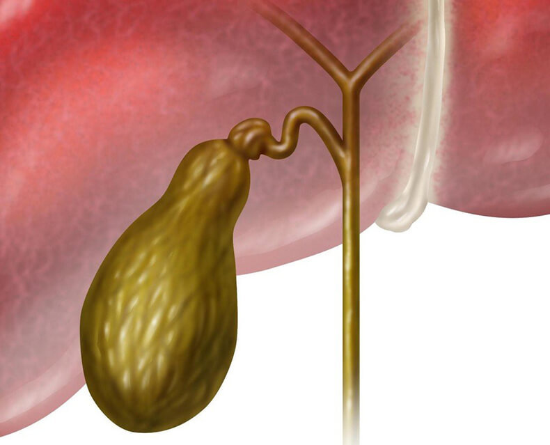Застой желчи: как избавиться от холестаза