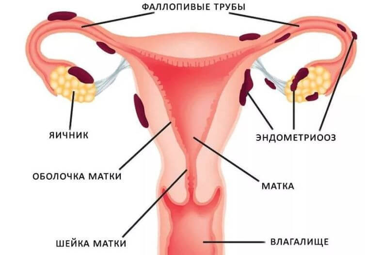 Нарушения цикла: причины и лечение согласно Аюрведе