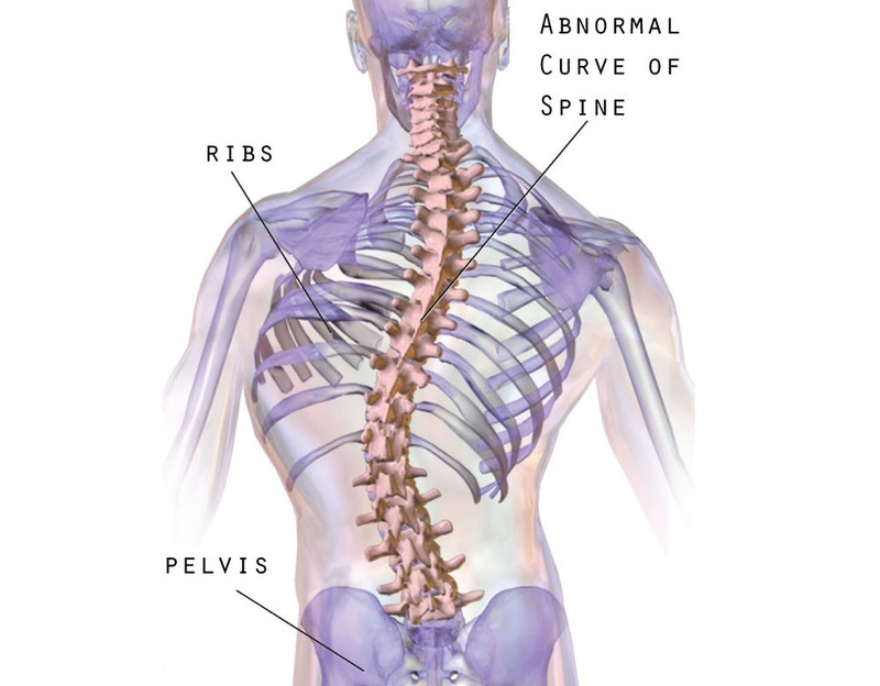 Висцеральные сколиозы: соответствие деформации позвоночника дисфункции конкретного органа
