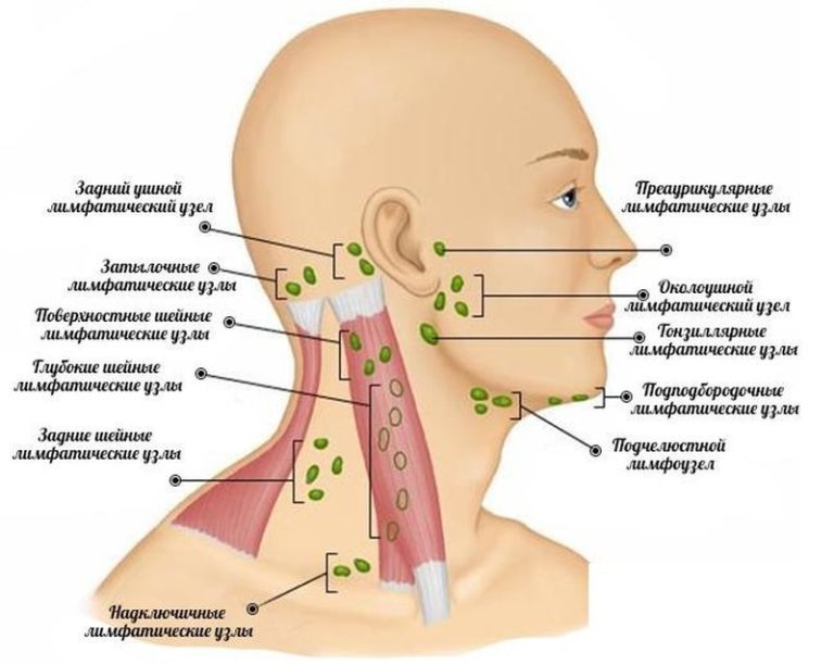 Увеличенные лимфоузлы: ЧТО может вызвать воспаление