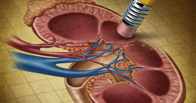 Почечная недостаточность — что надо знать