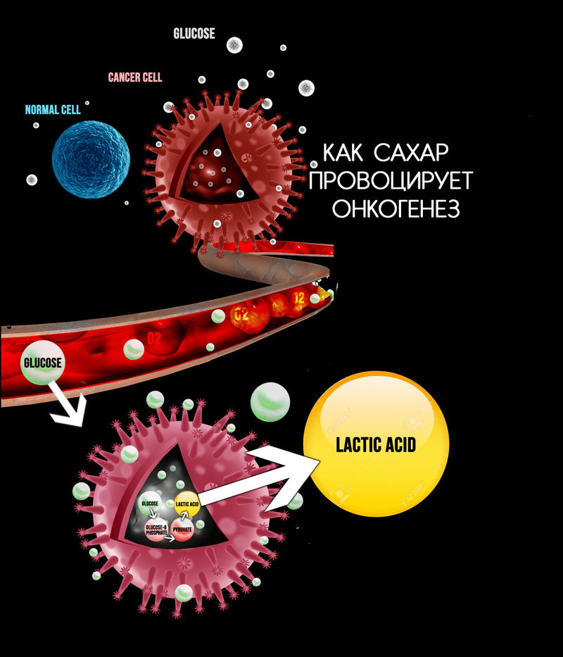 КАК сахар способствует развитию рака