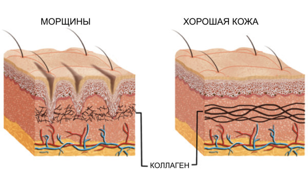 Как стимулировать выработку коллагена с помощью натуральных средств