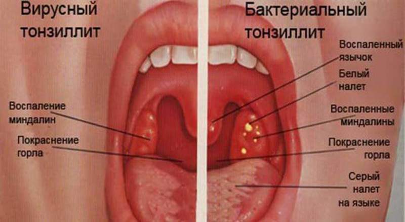 ИЗБАВЛЯЕМСЯ от вирусных и грибковых инфекций И НЕ ТОЛЬКО