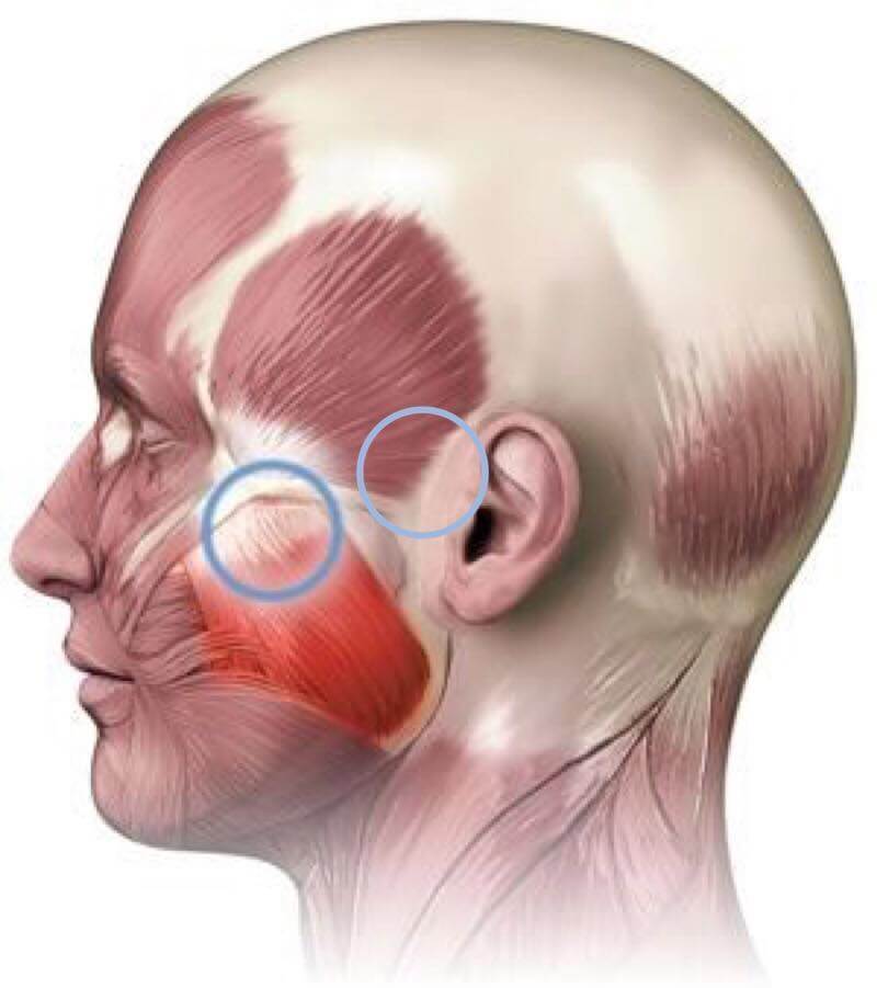Гипертонус жевательных мышц: на ЧТО влияет и КАК избавиться