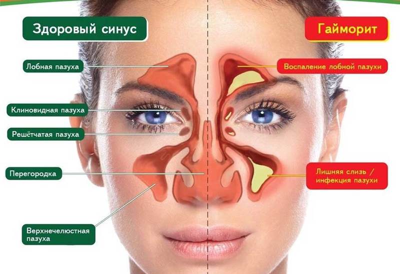 Опасность! Зависимость от капель в нос