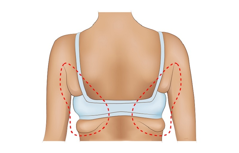 Как ИЗБАВИТЬСЯ от жира в области подмышек: 5 упражнений