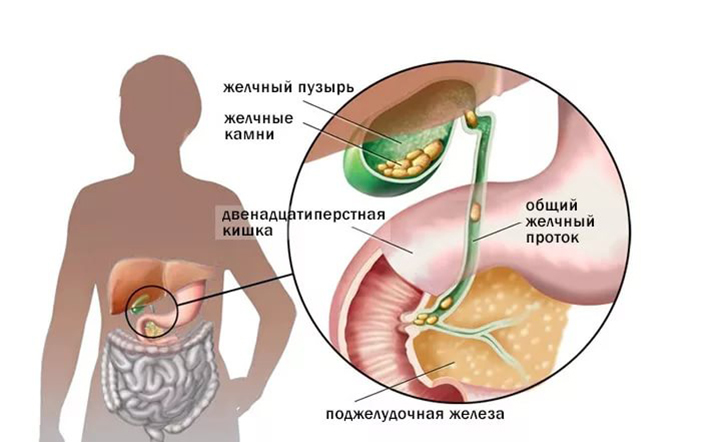 ПЕЧЕНЬ: лечебное питание для восстановления органа