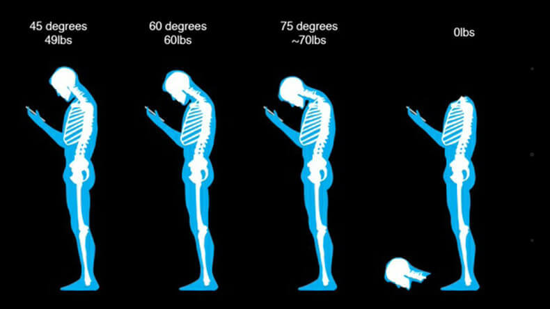 ОСТОРОЖНО ТЕХНОШЕЯ! Синдром смс-шеи — БОЛЬШЕ, чем просто сутулость