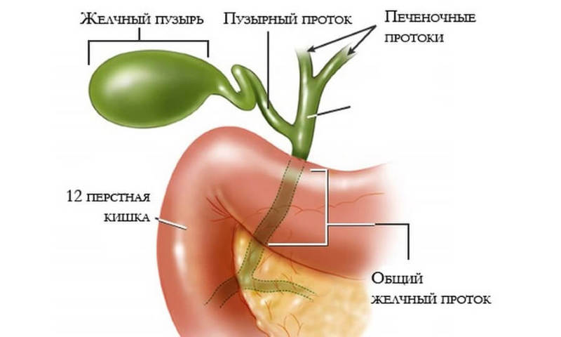 Холестатический ГЕПАТИТ: причины и симптомы