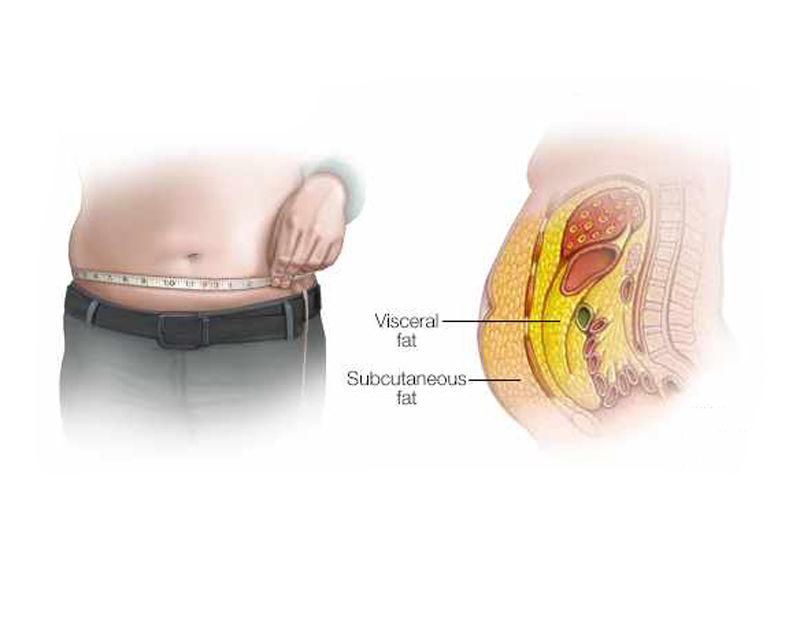 ЖИР на животе: Чем опасен и Как от него избавиться 