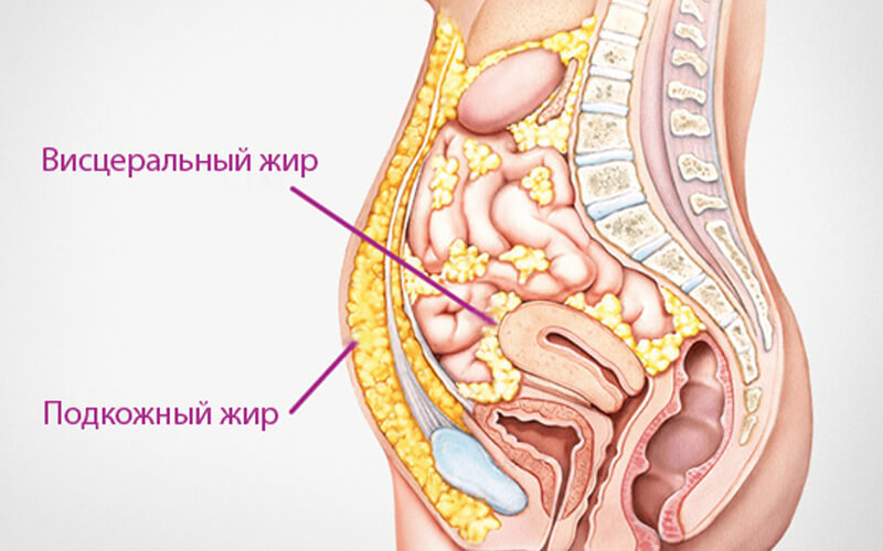 ВИСЦЕРАЛЬНЫЙ ЖИР: Как избавиться от внутреннего жира