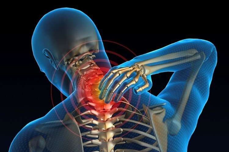 ШЕЙНЫЙ ОСТЕОХОНДРОЗ: Упражнения, которые избавят от отложения солей 