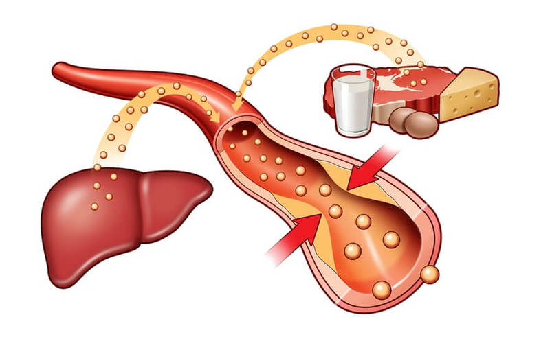 НОРМА ХОЛЕСТЕРИНА в крови у женщин и мужчин