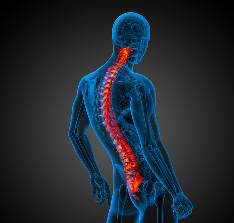 Сколиоз, лордоз и кифоз: Как выпрямить позвоночник