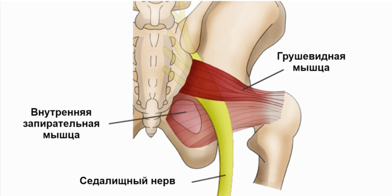 Синдром грушевидной мышцы: 10 упражнений, которые помогут