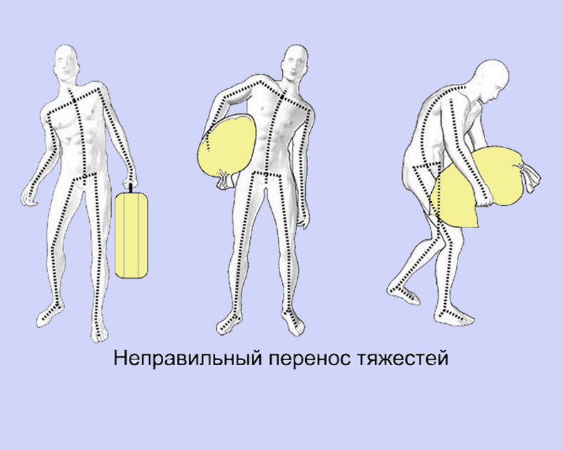 Грыжа поясничного отдела позвоночника: полезные и вредные упражнения