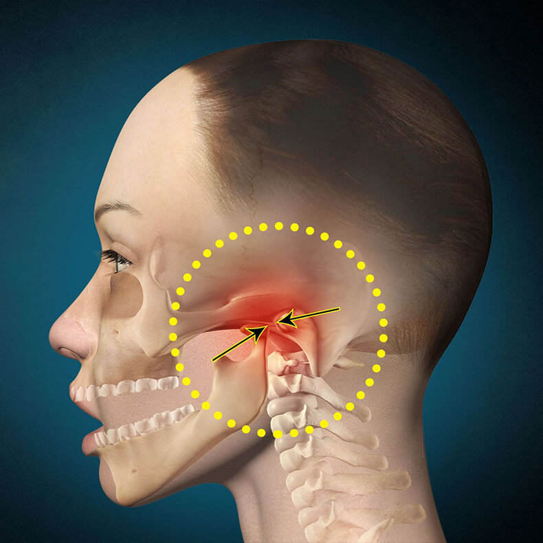 Дисфункции ВНЧС: 9 упражнений для височно-нижнечелюстного сустава