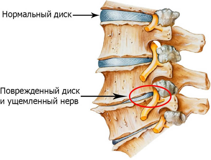 ДОРСАЛГИЯ: симптомы и лечение